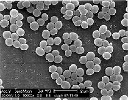 葡萄の可能性 全件 コラム ブログ 医薬品情報ならyjコード検索が可能な医薬情報研究所